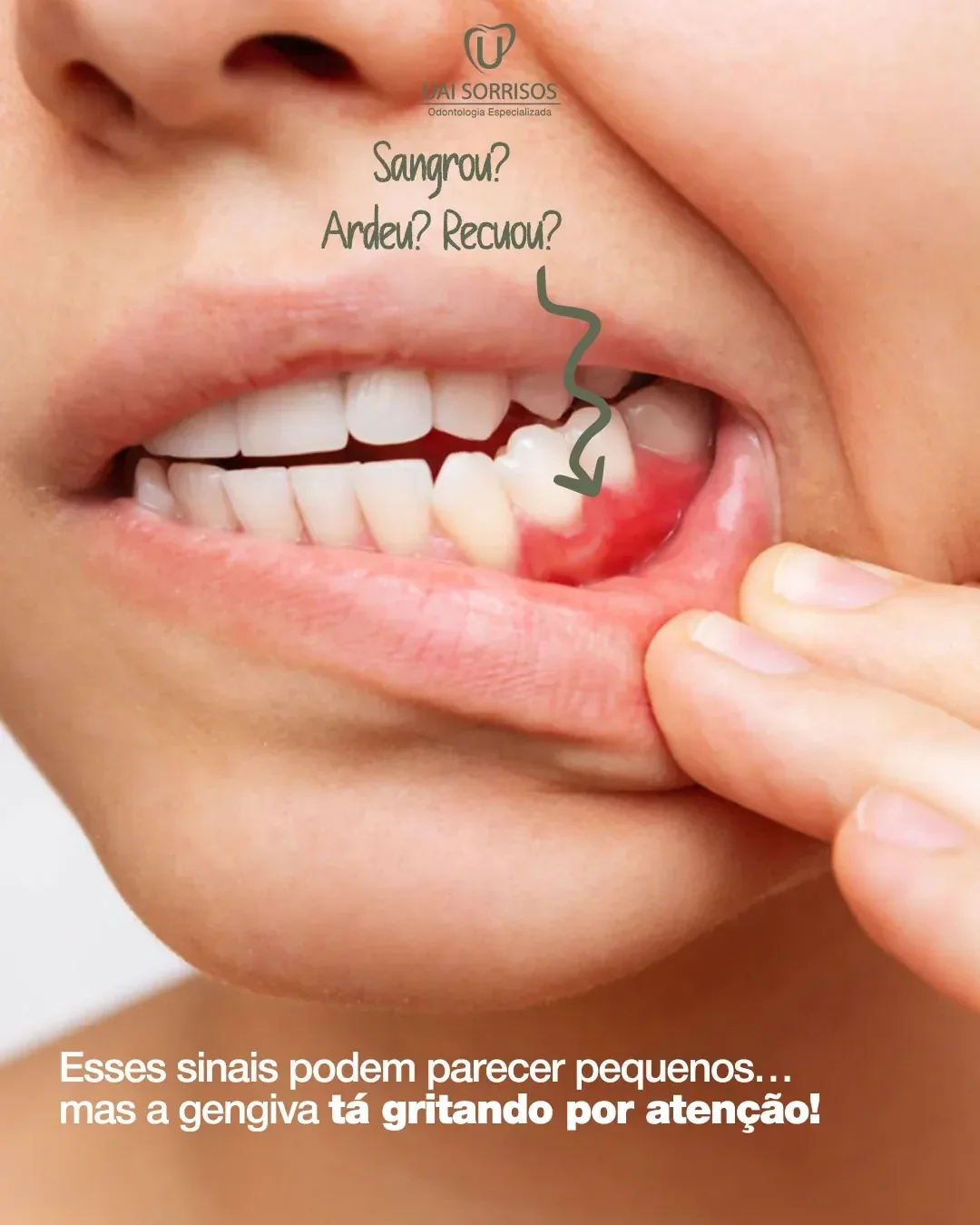 Periodontia em Itapetininga