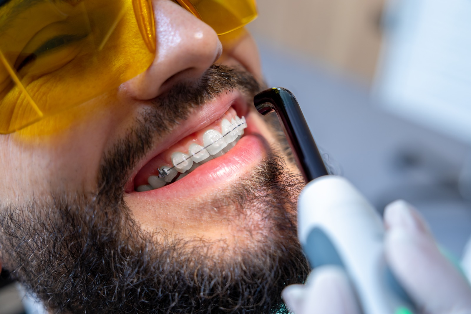 Ortodontia - Aparelhos Fixos e Invisíveis